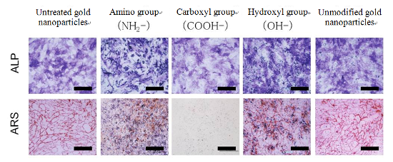 "Figure: Human mesenchymal stem cells (hMSCs) resulted from the following steps: each type of gold nanoparticles was added to hMSCs, and the treated cells were cultured for 3 weeks. The cells received either alkaline phosphatase (ALP) staining or alizarin red staining (ARS) of calcium phosphate deposits, both of which are osteogenic differentiation indicators. Control experiments with unmodified gold nanoparticles and untreated hMSCs were also carried out for comparison. In the upper images, ALP positive cells were stained purple while agglomerates of gold nanoparticles were detected as blue dots. In the lower images, spider-web-like red stains represent calcium phosphate deposits while bluish purple dots indicate agglomerates of gold nanoparticles. All scale bars are 500 μm." Image