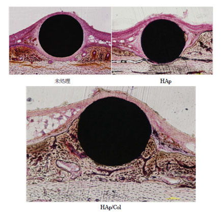 「プレス資料中の図2 : 手術後4週間の組織標本写真。上の二つはチタン材料 (黒) と骨組織 (茶色く染まっている) の間に軟組織 (ピンク色に染まっている) が介在しているが、下のHAp/Colでは材料と骨が直接結合している。」の画像