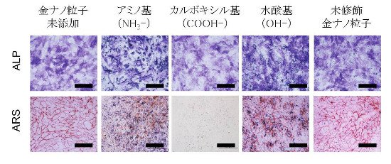 「プレスリリースの図2 : 　　各種金ナノ粒子を添加してヒト間葉系幹細胞 (hMSCs) を3週間培養し、骨分化の指標であるアルカリフォスファターゼ (ALP) 染色、沈着したリン酸カルシウムのアリザリンレッド染色 (ARS) を行った結果。比較のため、未修飾金ナノ粒子添加、無添加の条件でも実験を行った。上段の写真で紫色に染色された部分はアルカリフォスファターゼの存在領域、暗青色のドッドは金ナノ粒子の凝集体を示す。下段の写真でクモの巣状の赤い染色部分は、沈着したリン酸カルシウム、青紫色のドットは金ナノ粒子の凝集体を表す。スケールバーの長さはすべて500μm。」の画像